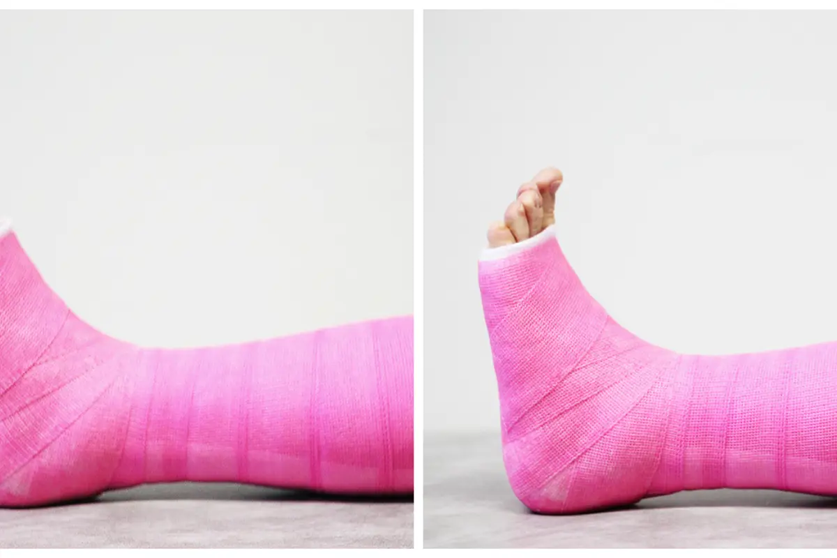 En kollasje av bandasjerte bein som gjør strekkeøvelser